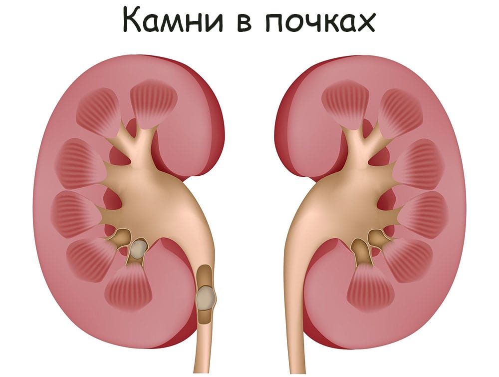 Кракен стор